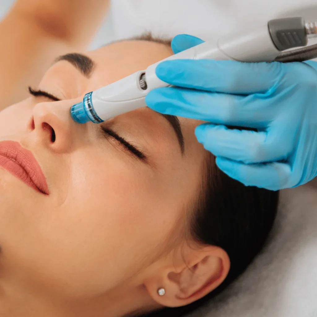 Hydrafacial cihazıyla uygulanan profesyonel cilt temizliği işlemi görseli