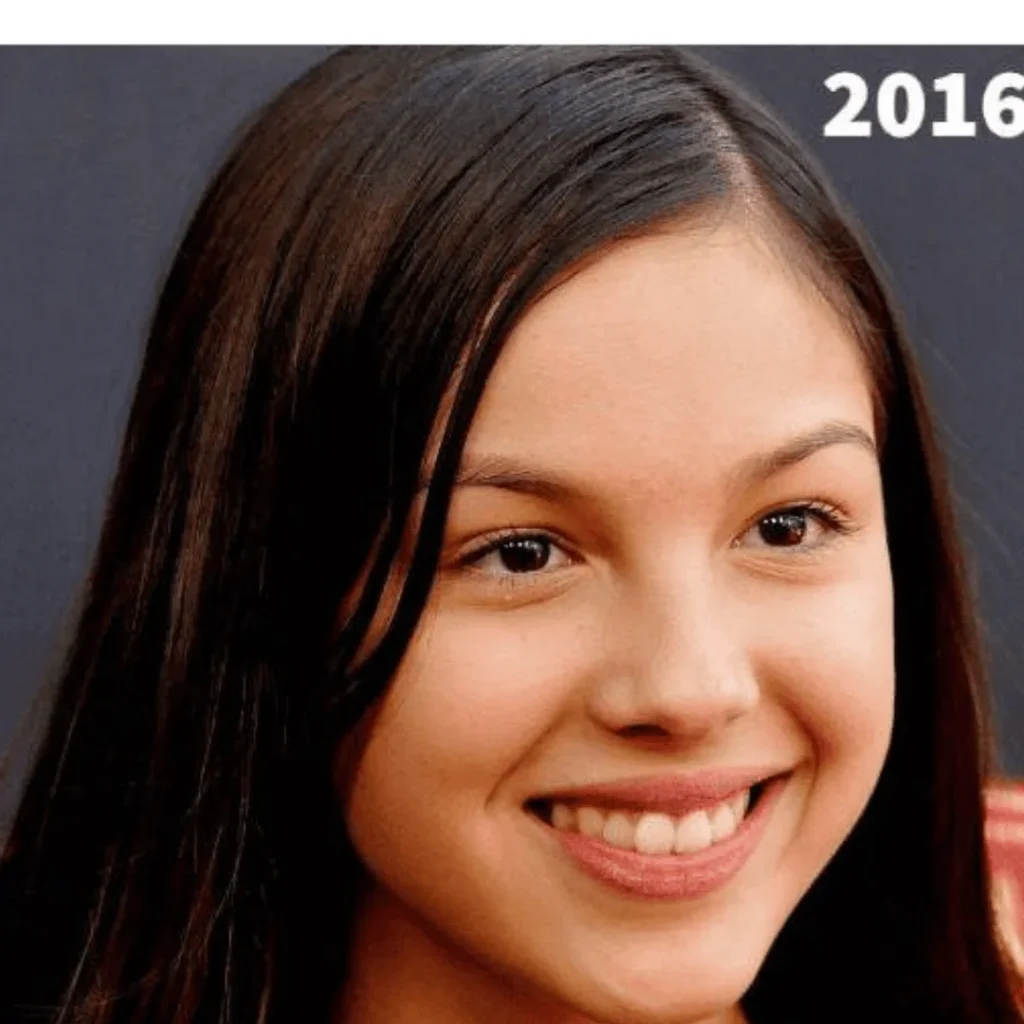 Olivia Rodrigo Estetik Ameliyatları | Tüm Detaylar 1 Olivia Rodrigo estetik ameliyatı öncesi ve sonrası yüz değişimi