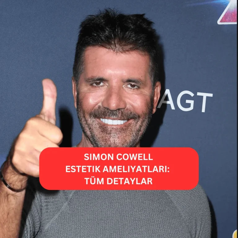 Simon Cowell’un estetik operasyonlarla değişen yüz hatları
