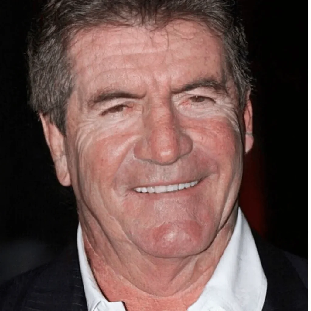 Simon Cowell Estetik Ameliyatları | Tüm Detaylar 1 Simon Cowell estetik ameliyatı öncesi ve sonrası yüz farkı