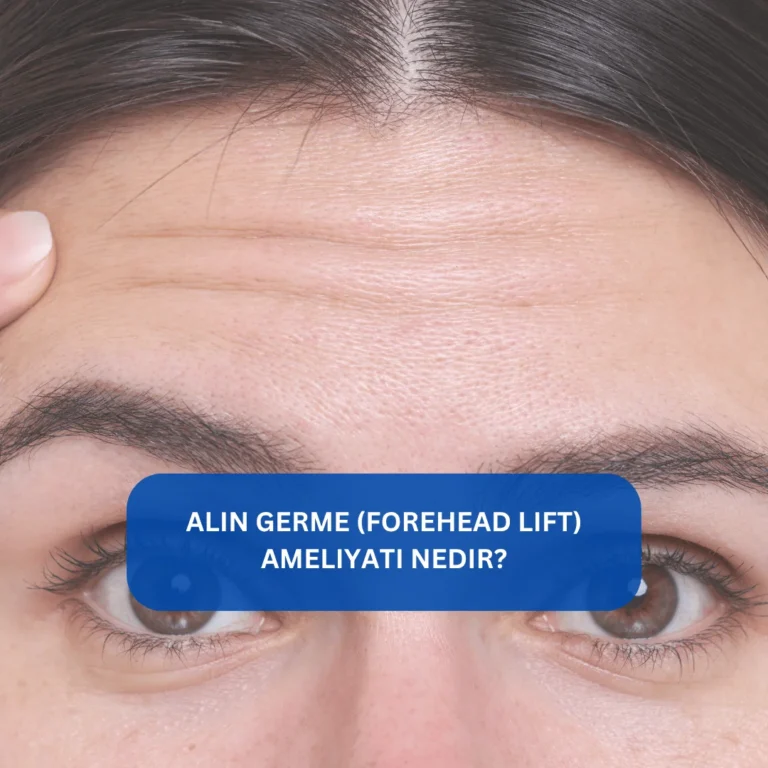 Alın Germe (Forehead Lift) Ameliyatı Nedir? Alın kırışıklığı düzeltme estetiği Forehead lift ameliyatı sonrası daha gergin alın ve kalkık kaş görünümü