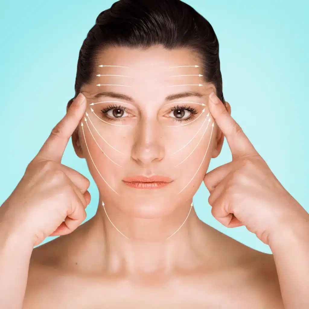 Ameliyatsız yüz germe sonrası cilt gençleştirme örneği