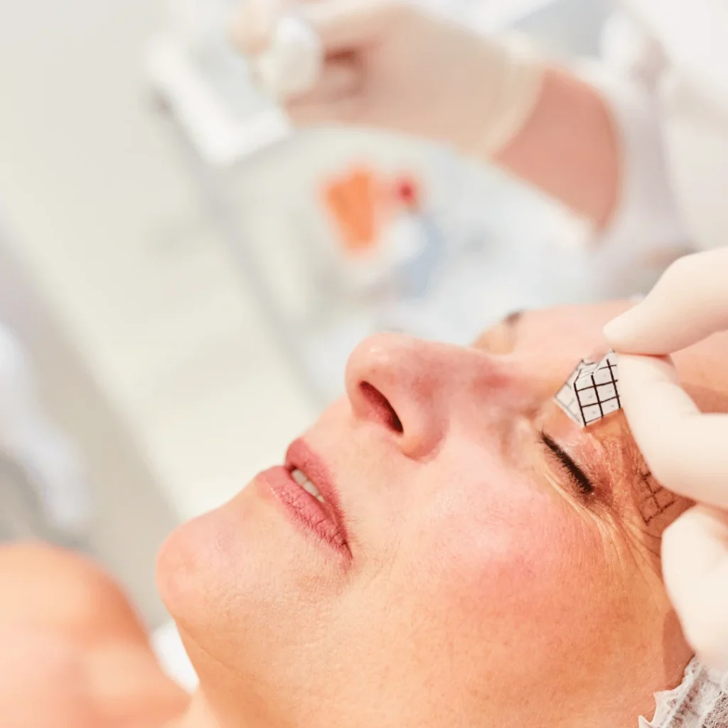 Aynı anda burun ve göz kapağı estetiği yaptırmış kadının işlem sonrası görünümü

