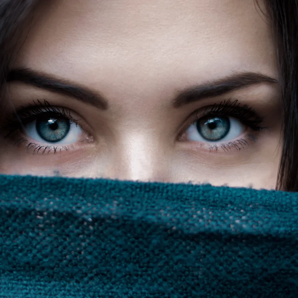 Bella Eyes estetiği sonrası çekik göz görünümü kazanan yüz