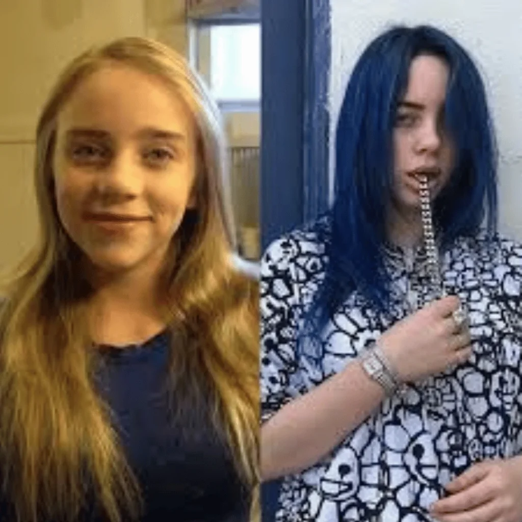 Billie Eilish Estetik Ameliyatları | Tüm Detaylar 1 Billie Eilish estetik ameliyatı öncesi ve sonrası yüz farkı