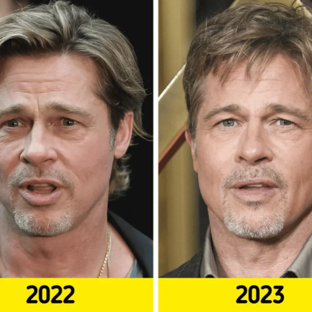 Brad Pitt Estetik Ameliyatları | Tüm Detaylar 1 Brad Pitt estetik ameliyatı öncesi ve sonrası yüz farkı