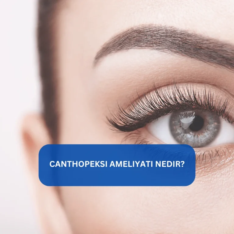 Göz kenarlarını yukarı çeken canthopeksi ameliyatı görseli