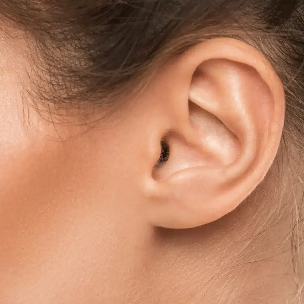 Çocuklar için kepçe kulak estetiği operasyonunu anlatan görsel