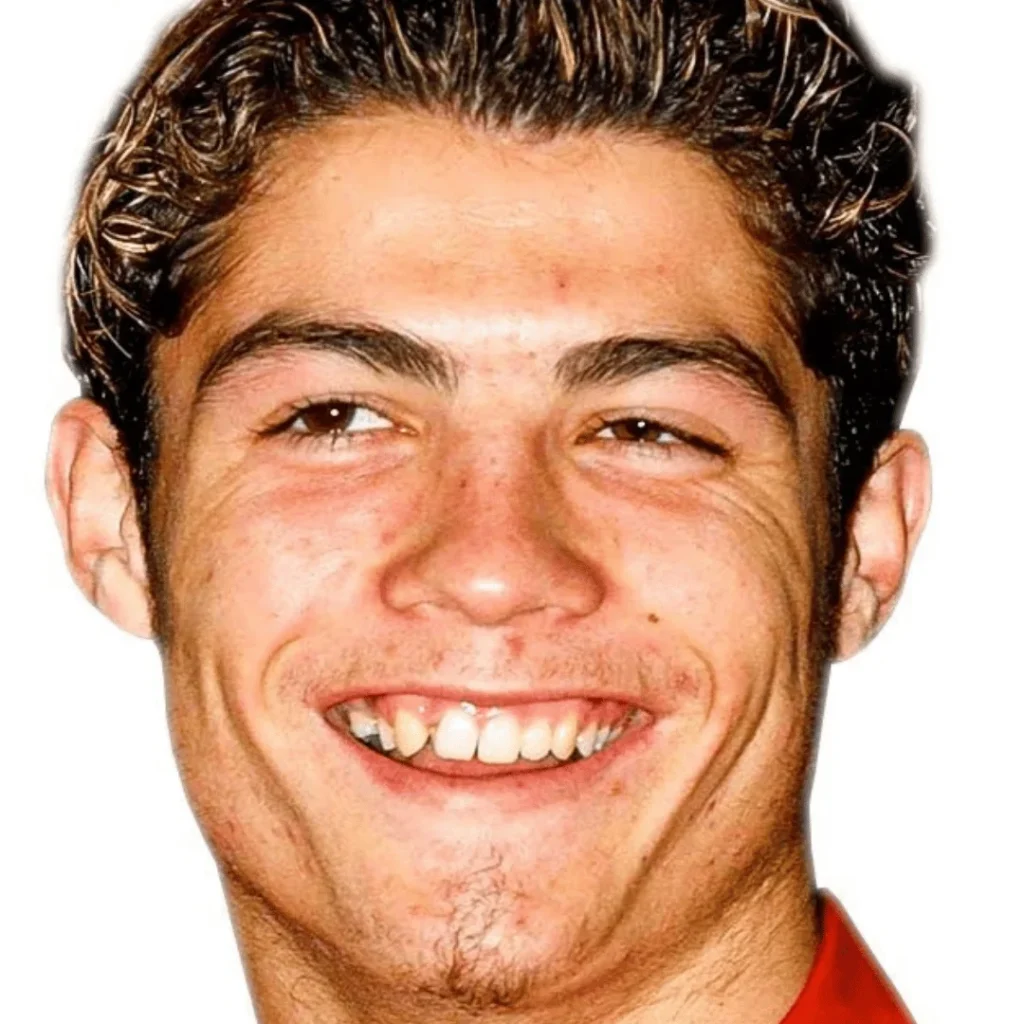 Cristiano Ronaldo Estetik Ameliyatları | Tüm Detaylar 1 Cristiano Ronaldo estetik ameliyatı öncesi ve sonrası yüz farkı