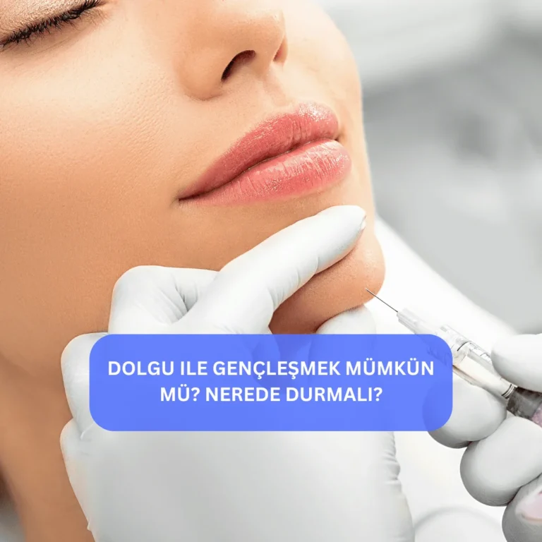 Dolgu uygulaması sonrası yüz hatları belirginleşmiş kadının karşılaştırmalı görünümü