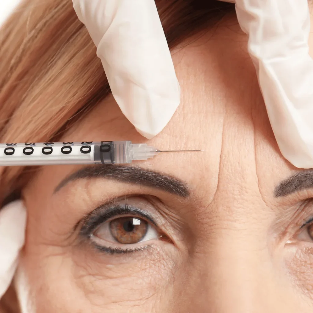 Dolgu Mu Botoks Mu? Hangi Estetik İşlem Size Uygun? 1 Aynı kişide dolgu ve botoks işlemleri sonrası yüz görünümündeki fark