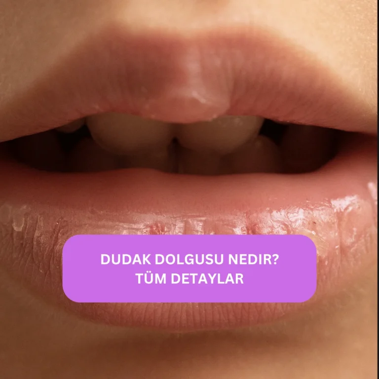 Dudak Dolgusu Nedir? Bilmeniz Gereken Her Şey | Kapsamlı Rehber Güzelliğinize Zarif Bir Dokunuş