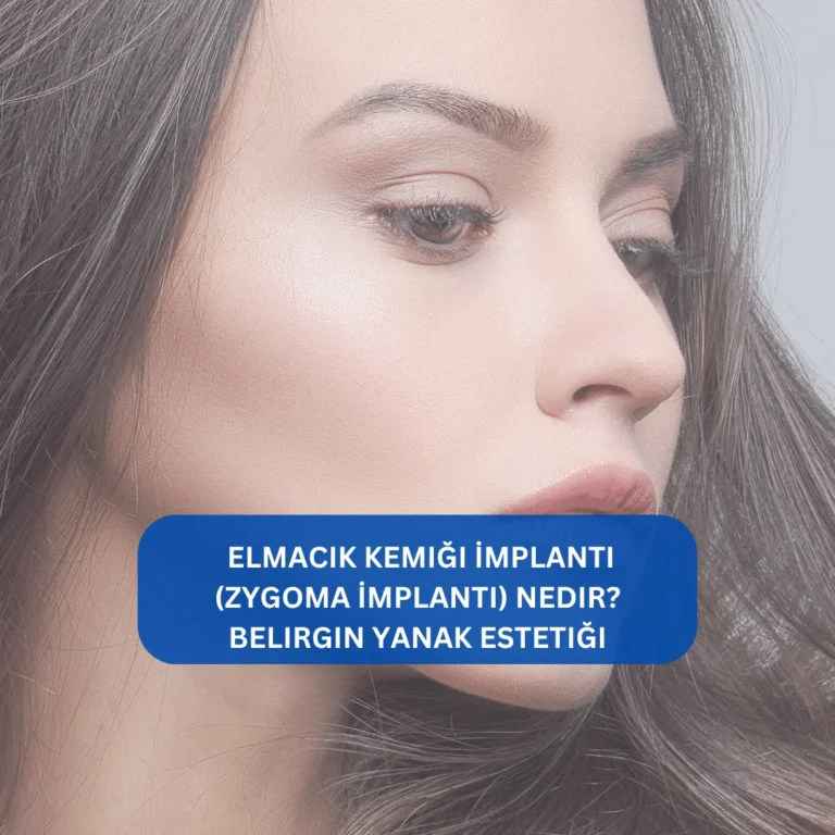 Elmacık Kemiği İmplantı (Zygoma İmplantı) Nedir? Belirgin yanak estetiği Elmacık kemiği implantı sonrası yüz hatlarında meydana gelen değişim