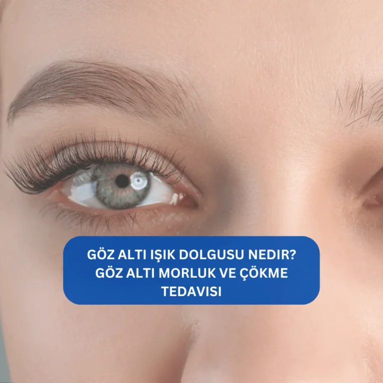 Göz Altı Işık Dolgusu Nedir? Göz altı morluk ve çökme tedavisi Işık dolgusu sonrası daha genç ve canlı göz çevresi görünümünü gösteren görsel