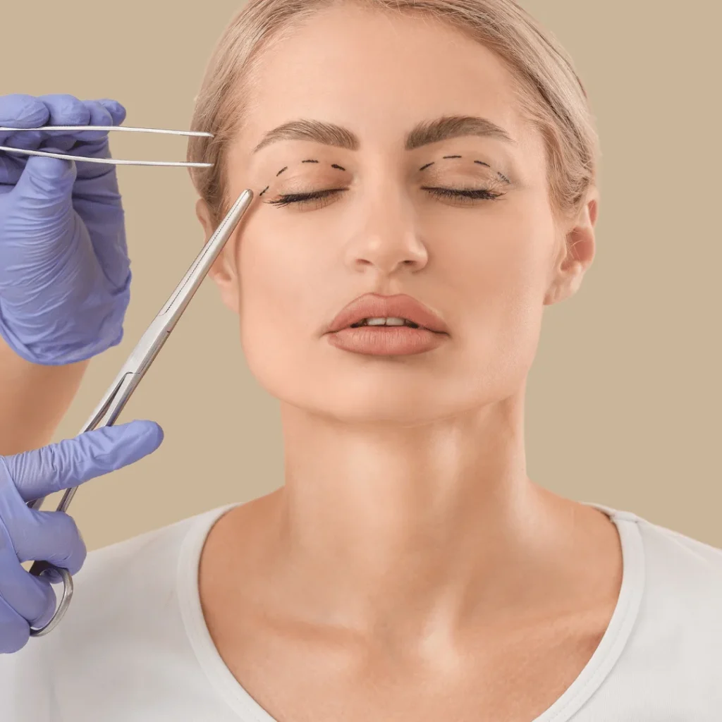 Göz Kapağı Ameliyatı (Blefaroplasti) Nedir?