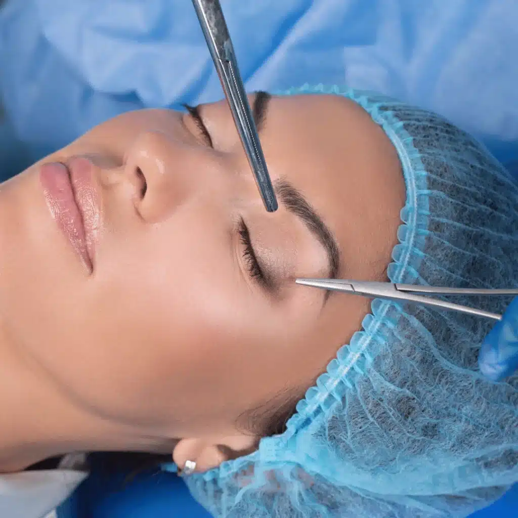 Blefaroplasti ameliyatı öncesi ve sonrası görsel fark