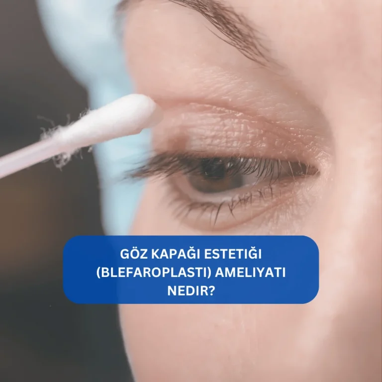 Göz kapağı estetiği sonrası değişimi gösteren örnek görsel