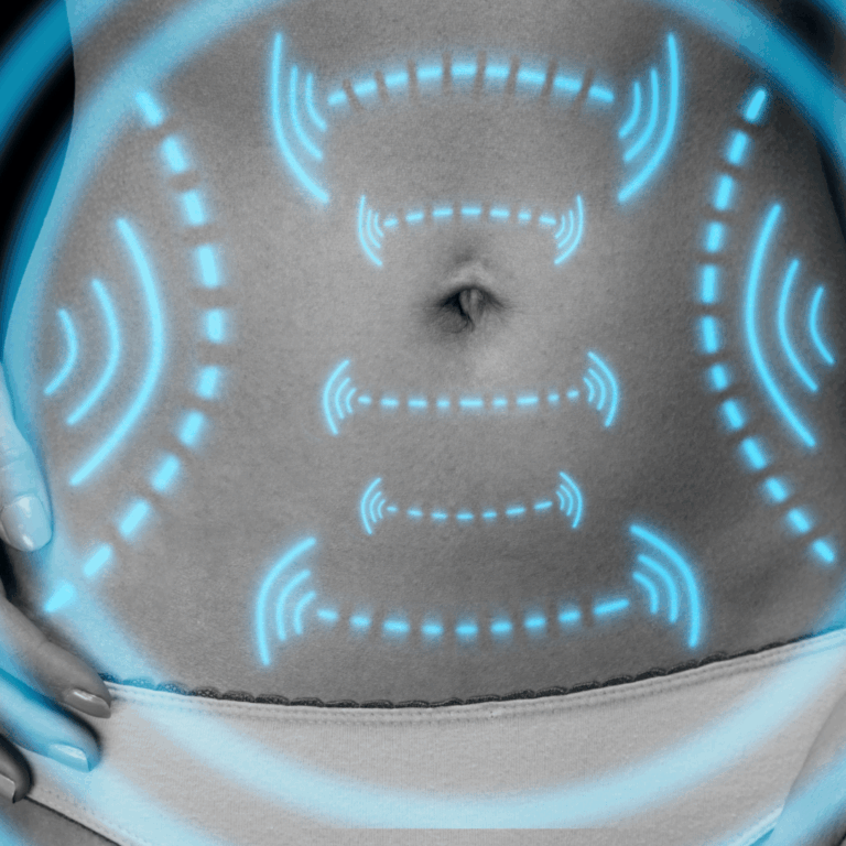 Güncel Liposuction Fiyatları: Bölgelere ve Tekniklere Göre Maliyet Rehberi Karın, bel, basen gibi bölgelere göre liposuction fiyat karşılaştırması