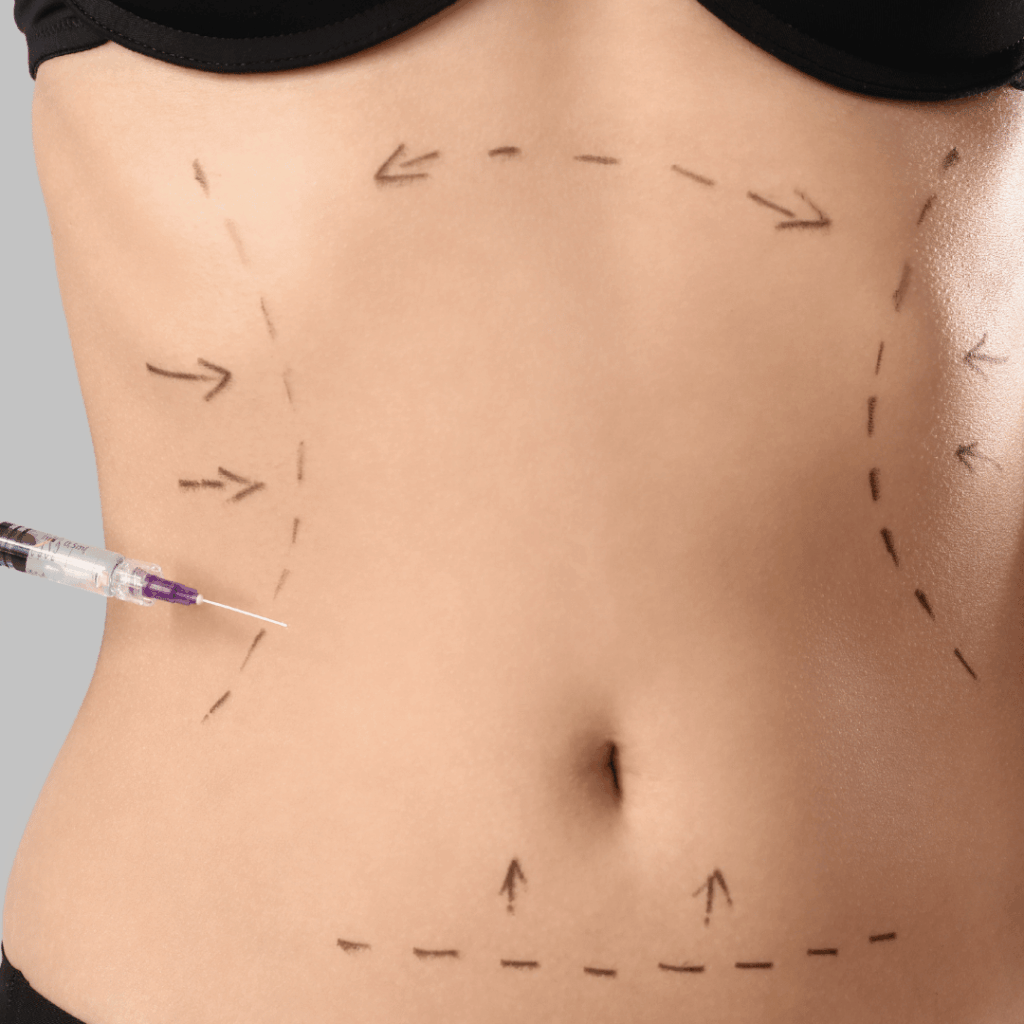 liposuction estetiği fiyatlarını gösteren bilgilendirici görsel