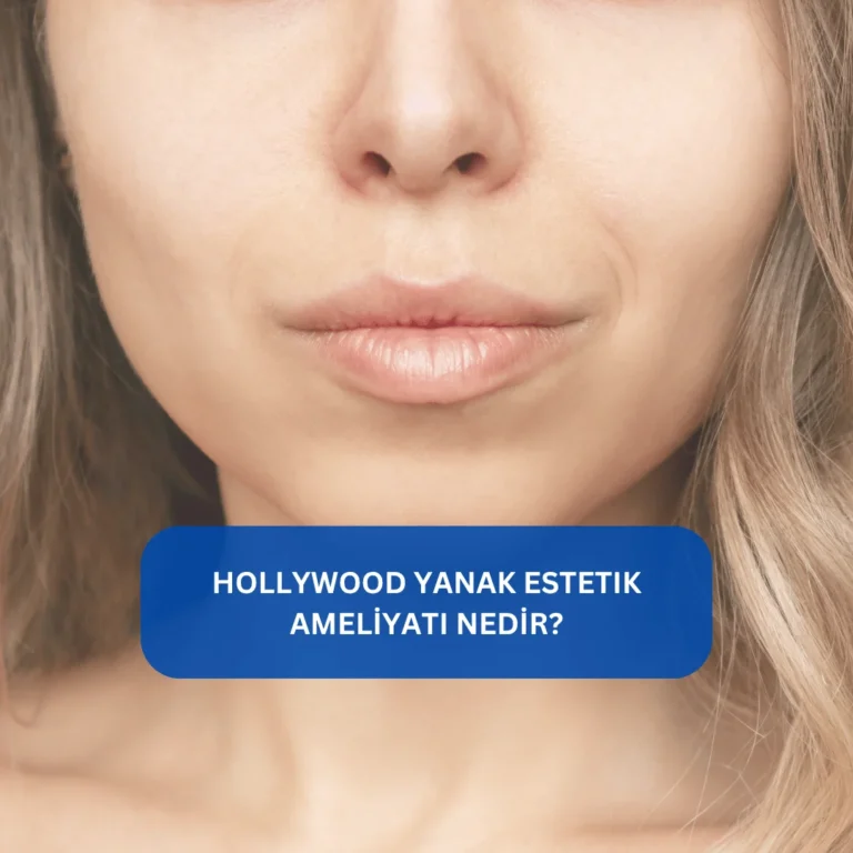 Bişektomi (Yanak Estetiği) Ameliyatı Nedir? Hollywood yanak estetiği ollywood Face ameliyatı ile yüz hatlarının belirginleştirilmesini anlatan görsel