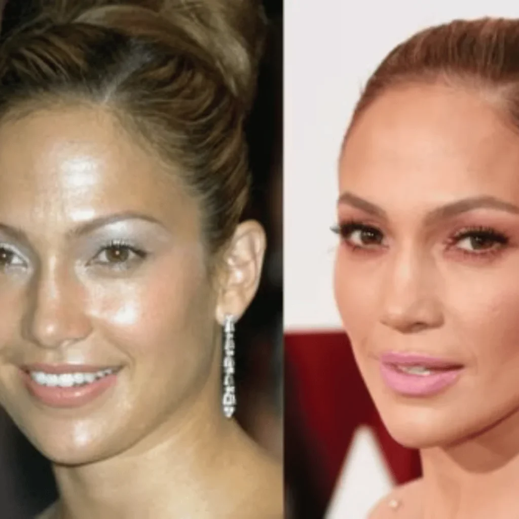 Jennifer Lopez Estetik Ameliyatları | Tüm Detaylar 1 Jennifer Lopez estetik ameliyatı öncesi ve sonrası yüz değişimi