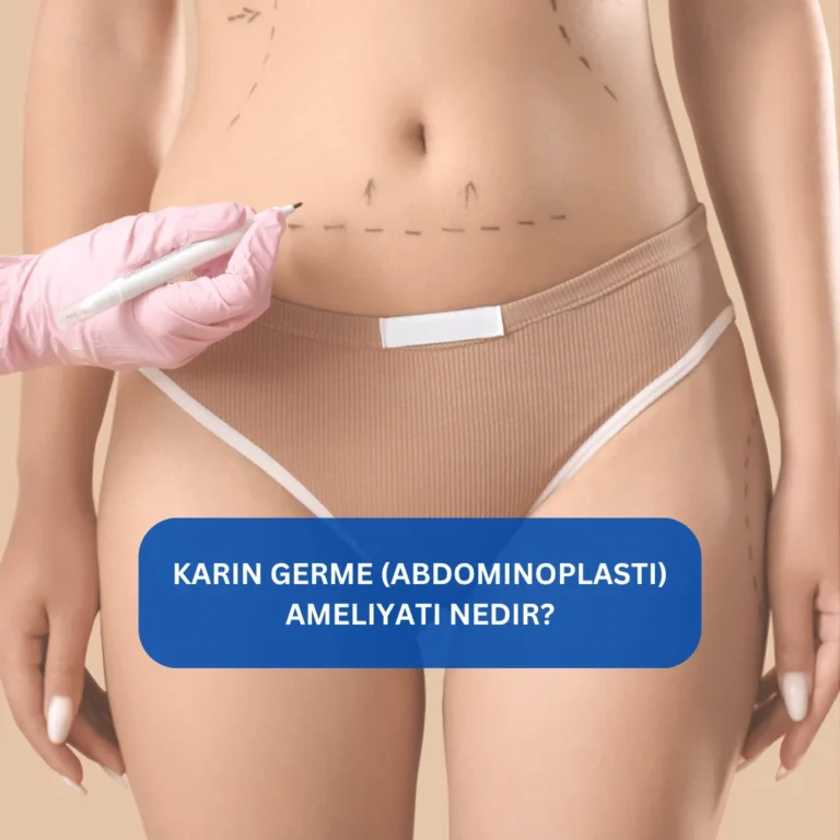 Abdominoplasti işlemi sonrası karın bölgesindeki değişimi gösteren görsel