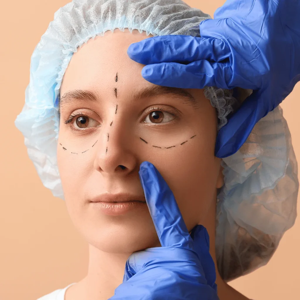 Kaşların yukarı çekilmesiyle daha genç bir görünüm sağlayan kaş askısı estetiği görseli