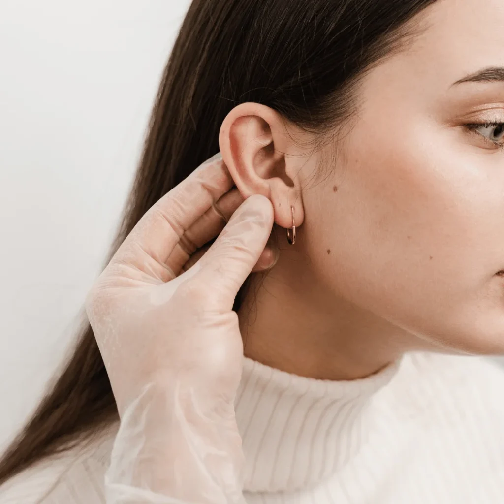 Otoplasti ameliyatı öncesi ve sonrası kulak görünümü farkı