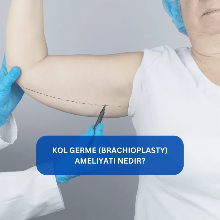 Kol Germe (Brachioplasty) Ameliyatı Nedir? Kol sarkması ameliyatı Kol bölgesindeki sarkmaları gideren kol germe estetiği görseli