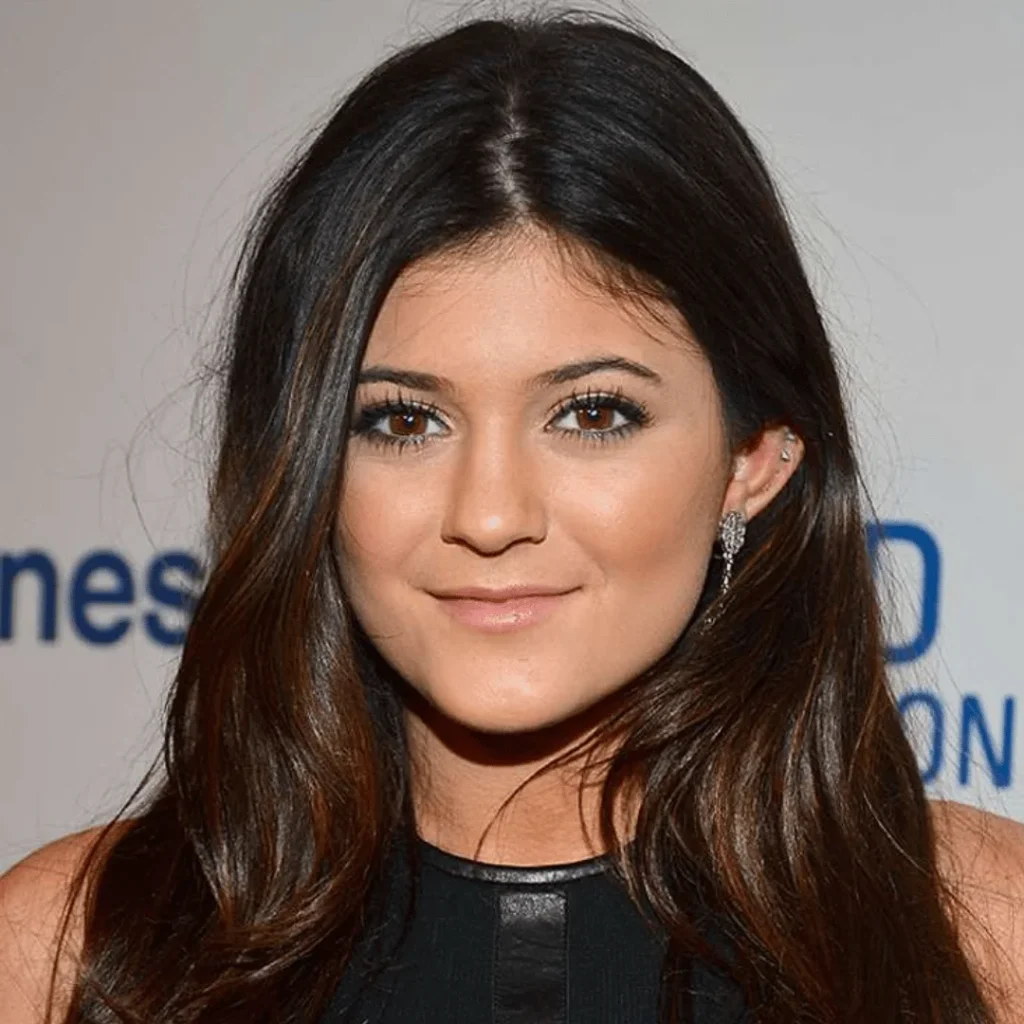 Kylie Jenner Estetik Ameliyatları | Tüm Detaylar 1 Kylie Jenner estetik operasyonlarla değişen görünümü