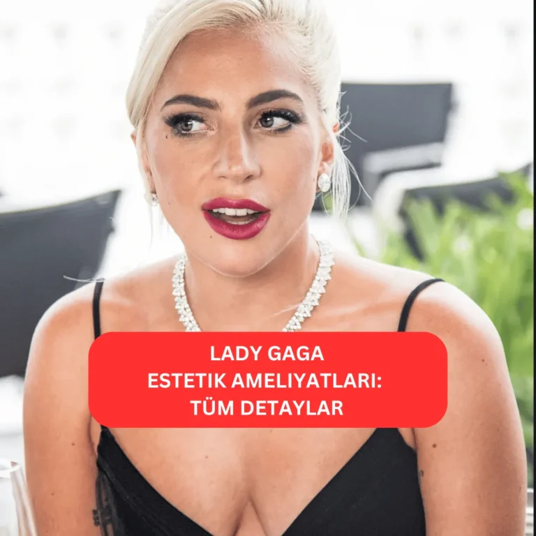 Lady Gaga’nın estetikle değişen yüz hatları