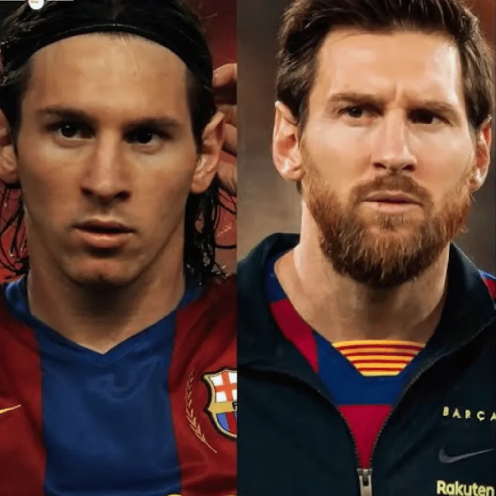 Lionel Messi Estetik Ameliyatları | Tüm Detaylar 1 Lionel Messi estetik ameliyatı öncesi ve sonrası yüz değişimi