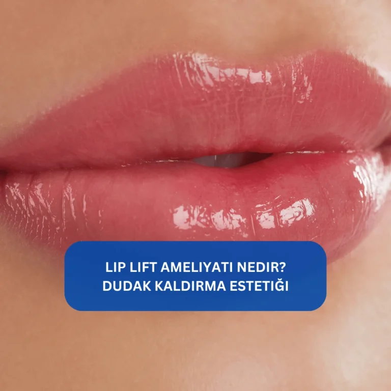 Lip Lift Ameliyatı Nedir? Dudak kaldırma estetiği Dudak ile burun arası mesafeyi kısaltan lip lift ameliyatı görseli