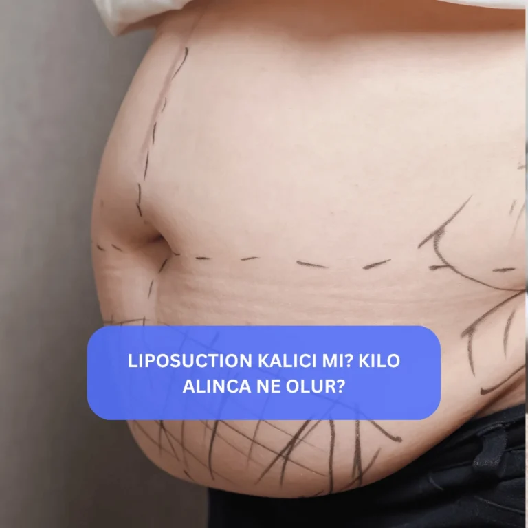 Liposuction Kalıcı mı? Kilo Alınca Ne Olur? Karın ve bel bölgesine liposuction uygulanan kadının önce ve sonra görünümü