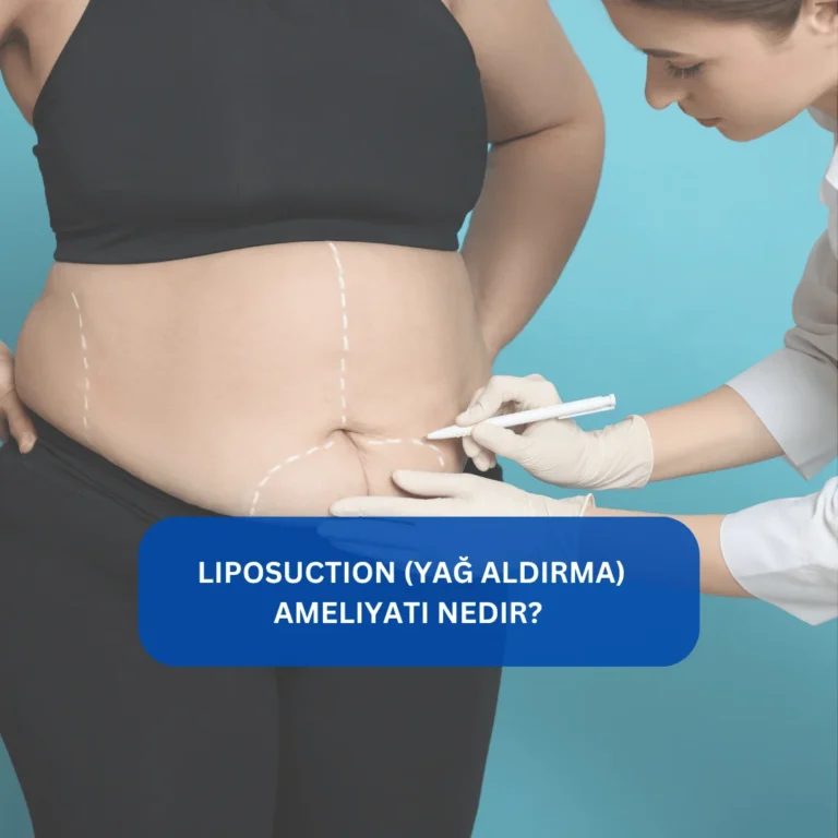 Liposuction ameliyatı öncesi ve sonrası vücut farkını gösteren görsel