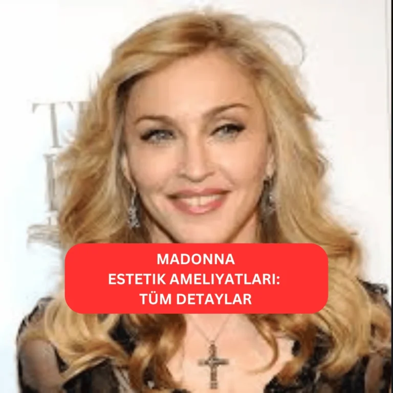 Madonna Estetik Ameliyatları | Tüm Detaylar Madonna’nın estetikle değişen yüz görünümü