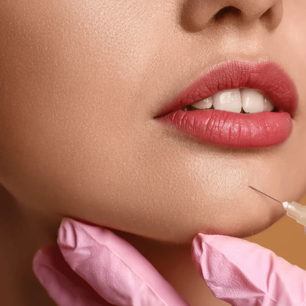 Masseter kasına uygulanan botoks ile yüz inceltme işlemi görseli