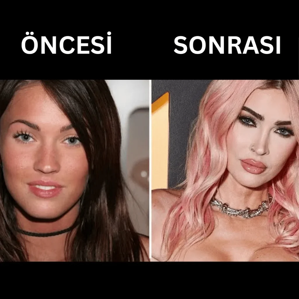 Megan Fox Estetik Ameliyatları | Tüm Detaylar 1 Megan Fox estetik ameliyatı öncesi ve sonrası yüz değişimi