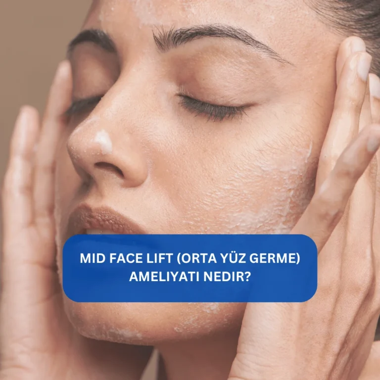 Mid Face Lift (Orta Yüz Germe) Ameliyatı Nedir? Elmacık kemiği ve yanak gençleştirme Orta yüz bölgesindeki sarkmaları hedef alan mid face lift estetiği görseli