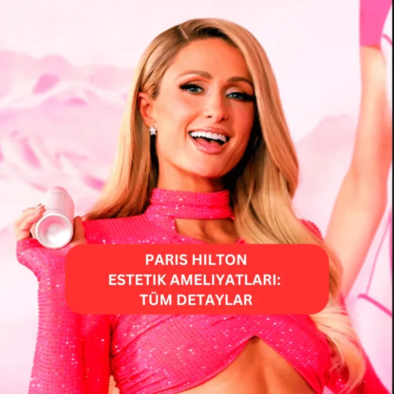 Paris Hilton’un estetikle değişen yüz hatları