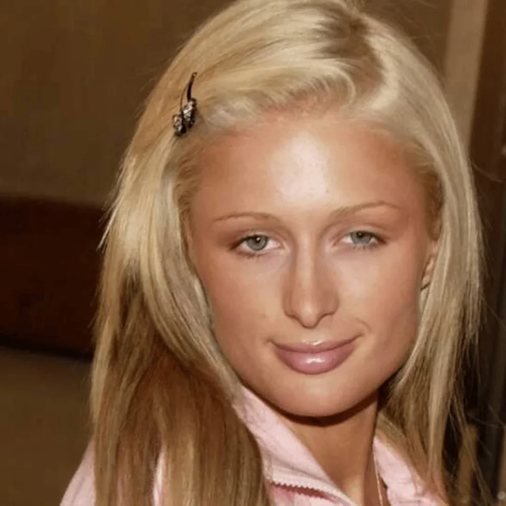 Paris Hilton Estetik Ameliyatları | Tüm Detaylar 1 Paris Hilton estetik ameliyatı öncesi ve sonrası yüz değişimi