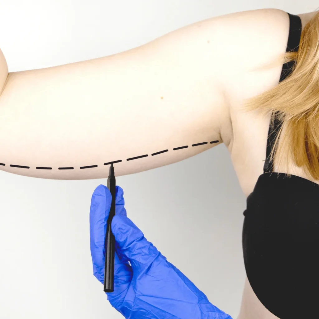 Kol germe ameliyatı öncesi ve sonrası görünüm farkını gösteren görsel