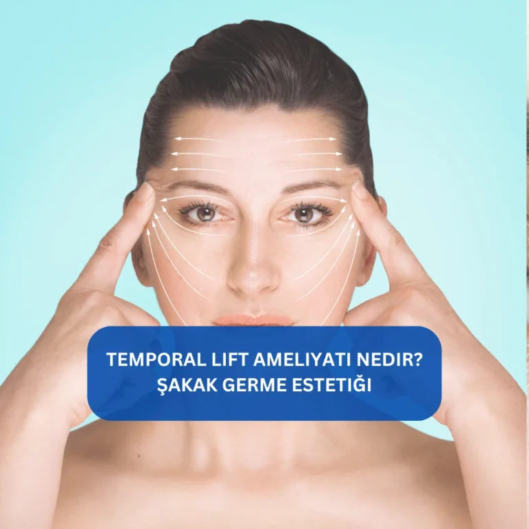 Temporal Lift Ameliyatı Nedir? Şakak germe estetiği Şakak bölgesindeki sarkmaları toparlayan temporal lift estetiği görseli
