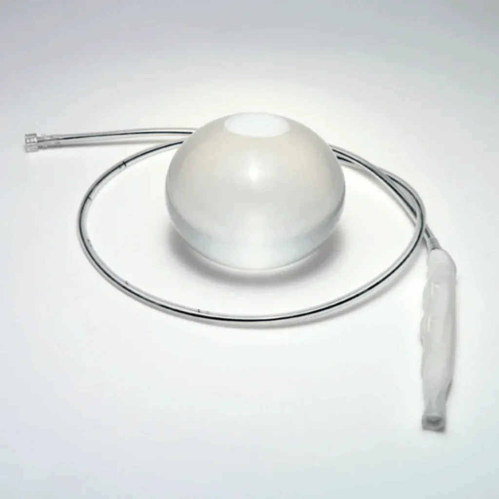 Mide balonu ile zayıflayan hastanın öncesi ve sonrası görünümü