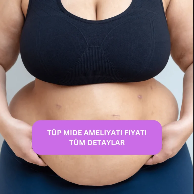 Tüp Mide Ameliyatı Fiyatı: Güncel Maliyetler ve Bilmeniz Gerekenler | Kapsamlı Analiz Tüp mide ameliyatı 2025 fiyat bilgisi