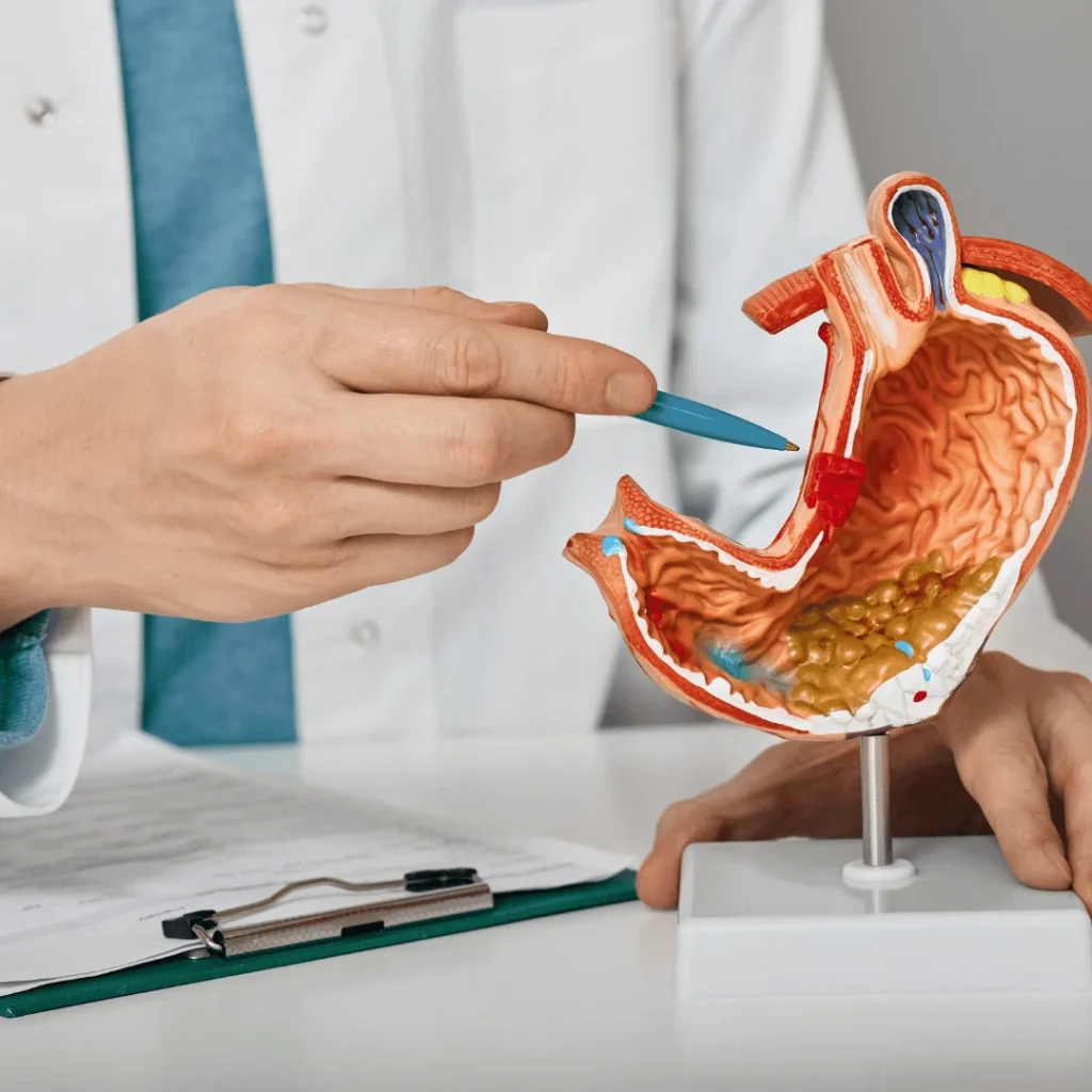 Tüp mide ameliyatı sonrası pişman olan hastaların gerçek yorumları