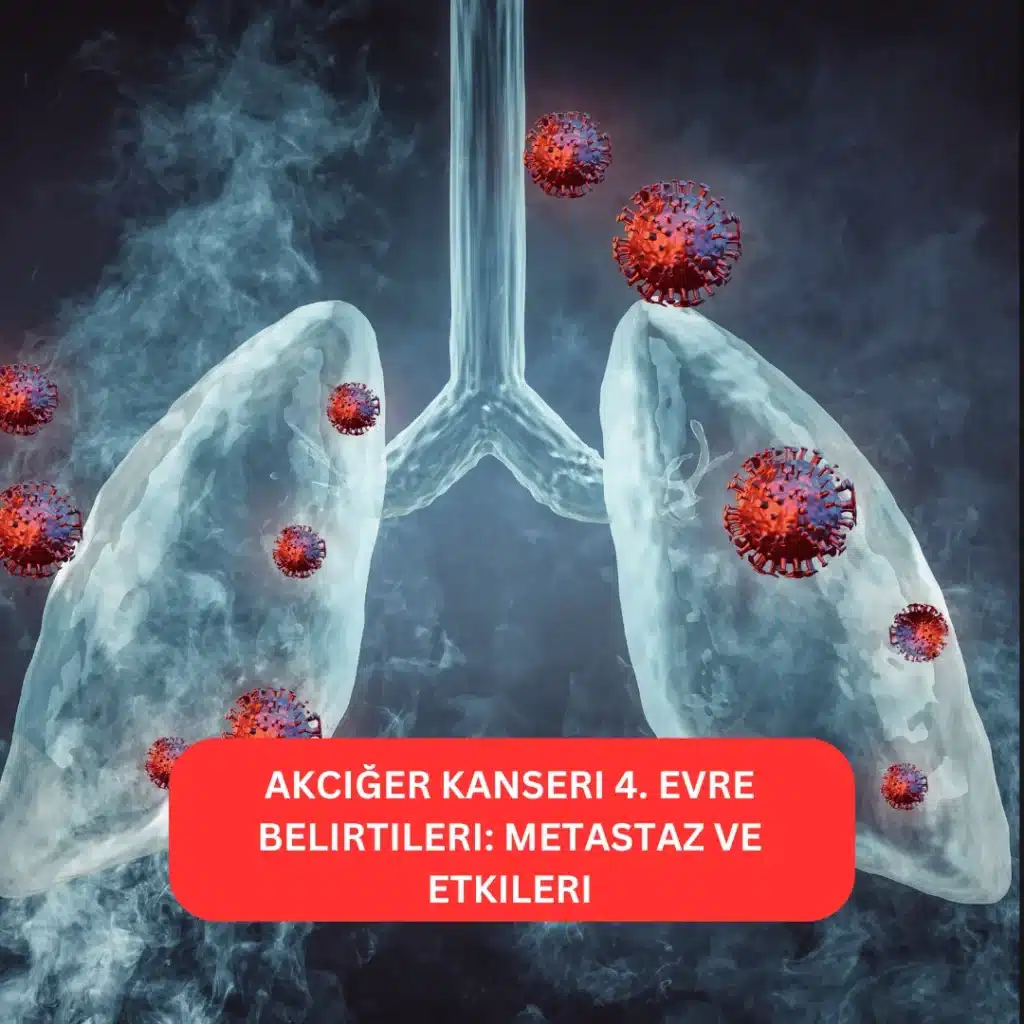 Akciğer Kanseri 4. Evre Belirtileri 1 Akciğer Kanseri 4. Evre Belirtileri