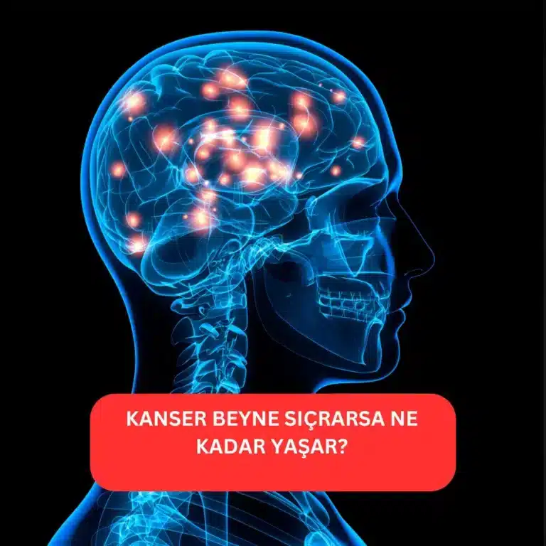 Kanser Beyne Sıçrarsa Ne Kadar Yaşar? Kanser Beyne Sıçrarsa Ne Kadar Yaşar