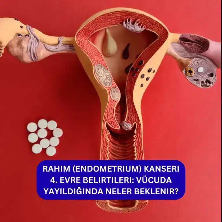 Rahim (Endometrium) Kanseri 4. Evre Belirtileri: Vücuda Yayıldığında Neler Beklenir? Rahim Kanseri 4. Evre Belirtileri.webp