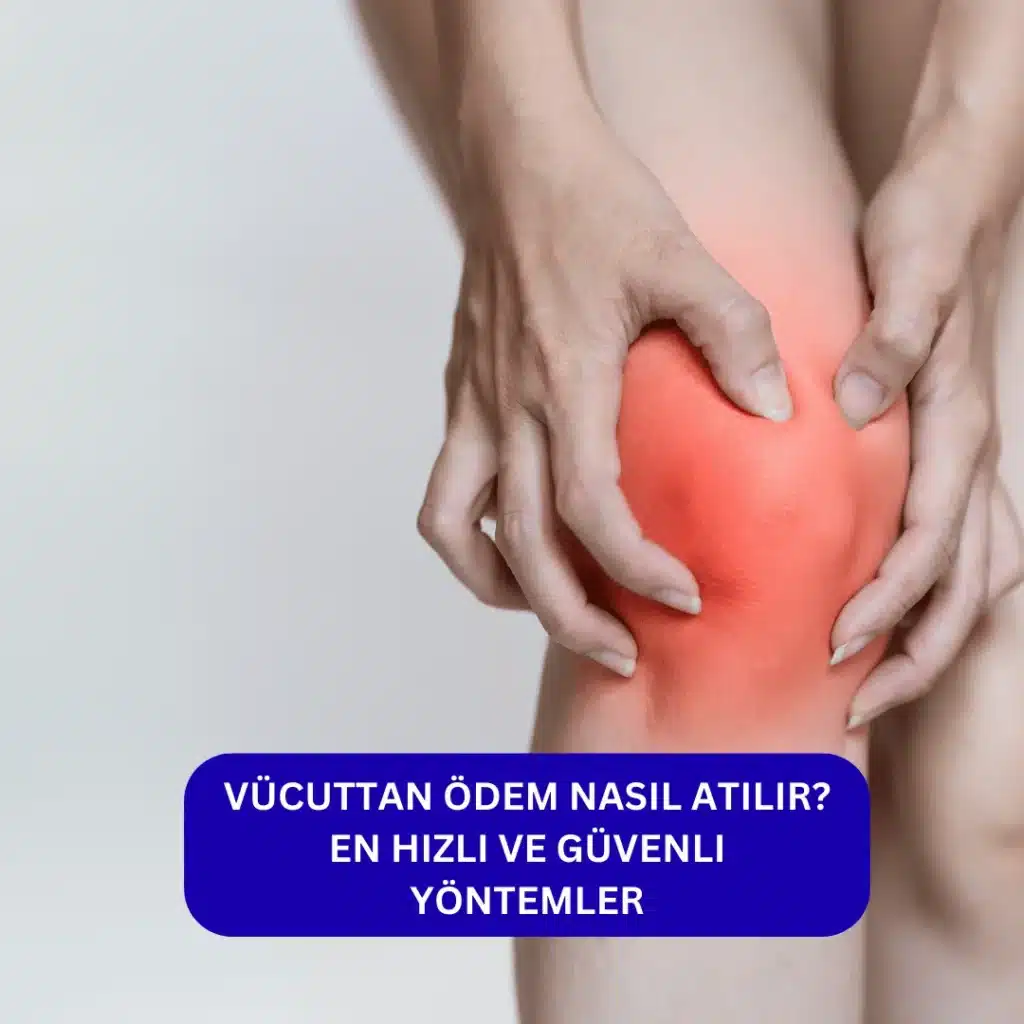 Vücuttan Ödem Nasıl Atılır? En Hızlı ve Güvenli Yöntemler